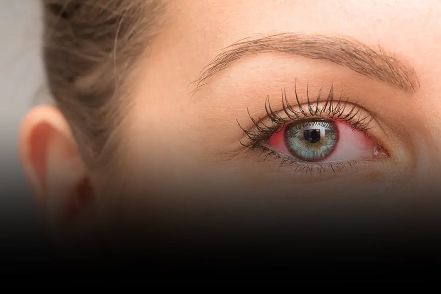 The Silent Thief of Sight How Glaucoma Affects Vision